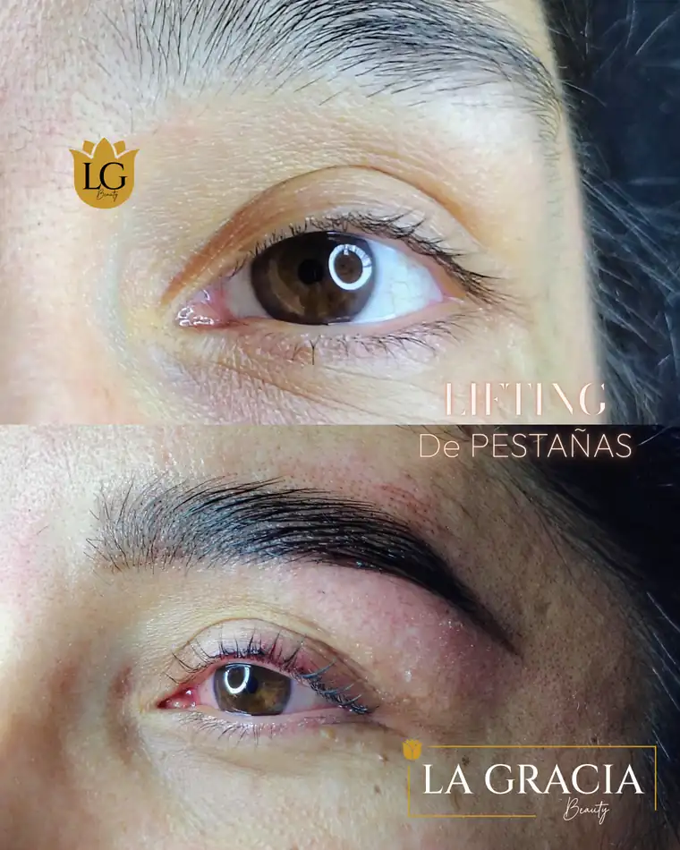 Antes y después de un lifting de pestañas hecho en La Gracia Beauty